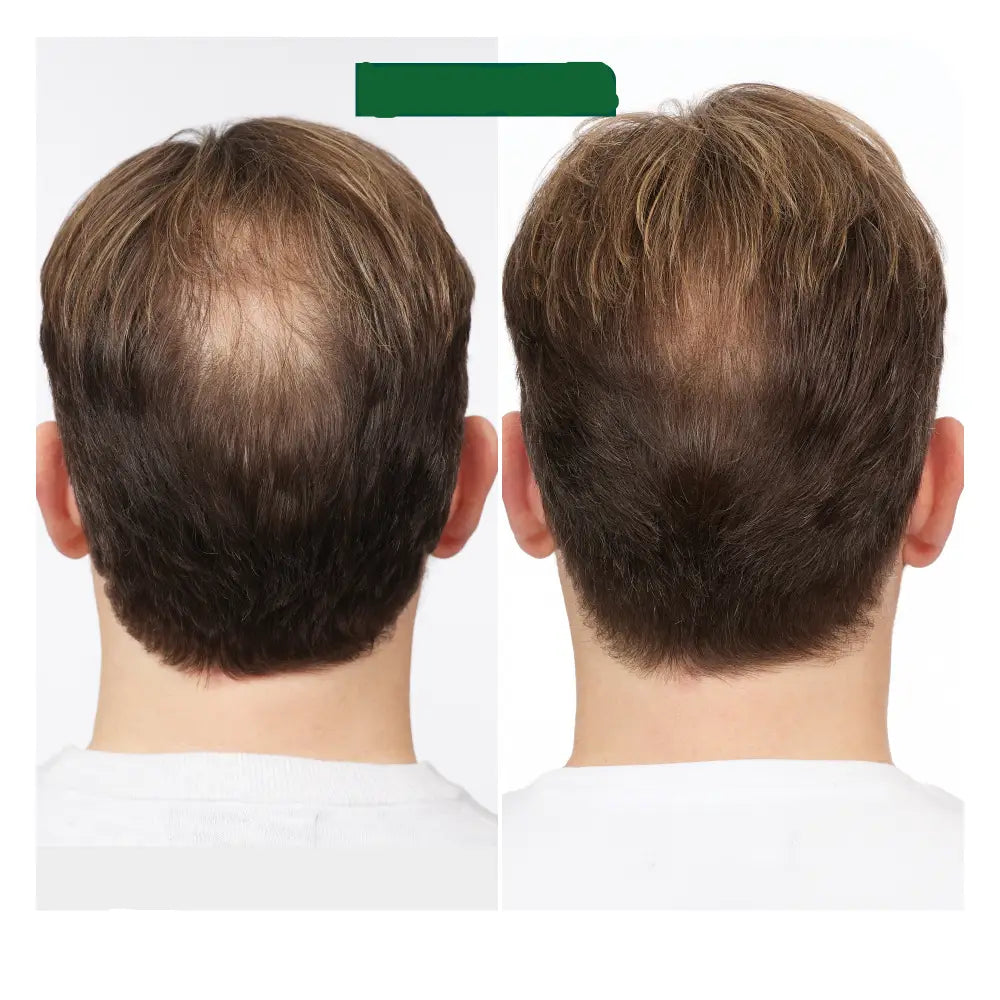 Biolage Full Rescue Aminexil Kezelés hajhullás ellen rozmaringolajjal és niacinamiddal – 6x10ml - Haj