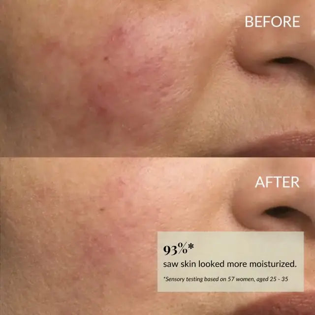 IREN Shizen DROP OF DEW 30 ml – Japán hidratáló arcolaj argánnal, prebiotikumokkal és posztbiotikumokkal, 100% természetes, bársonyos, ragyogó és védett bőrért