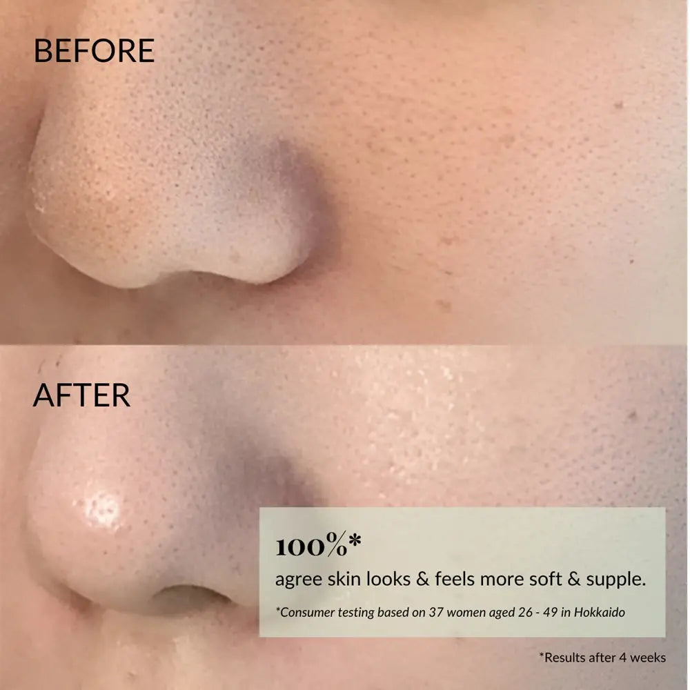 IREN Shizen FLOWERS IN BLOOM – Japán antioxidáns arckrém BIYUSEN™ termálvízzel | Mélyhidratálás természetes ragyogás