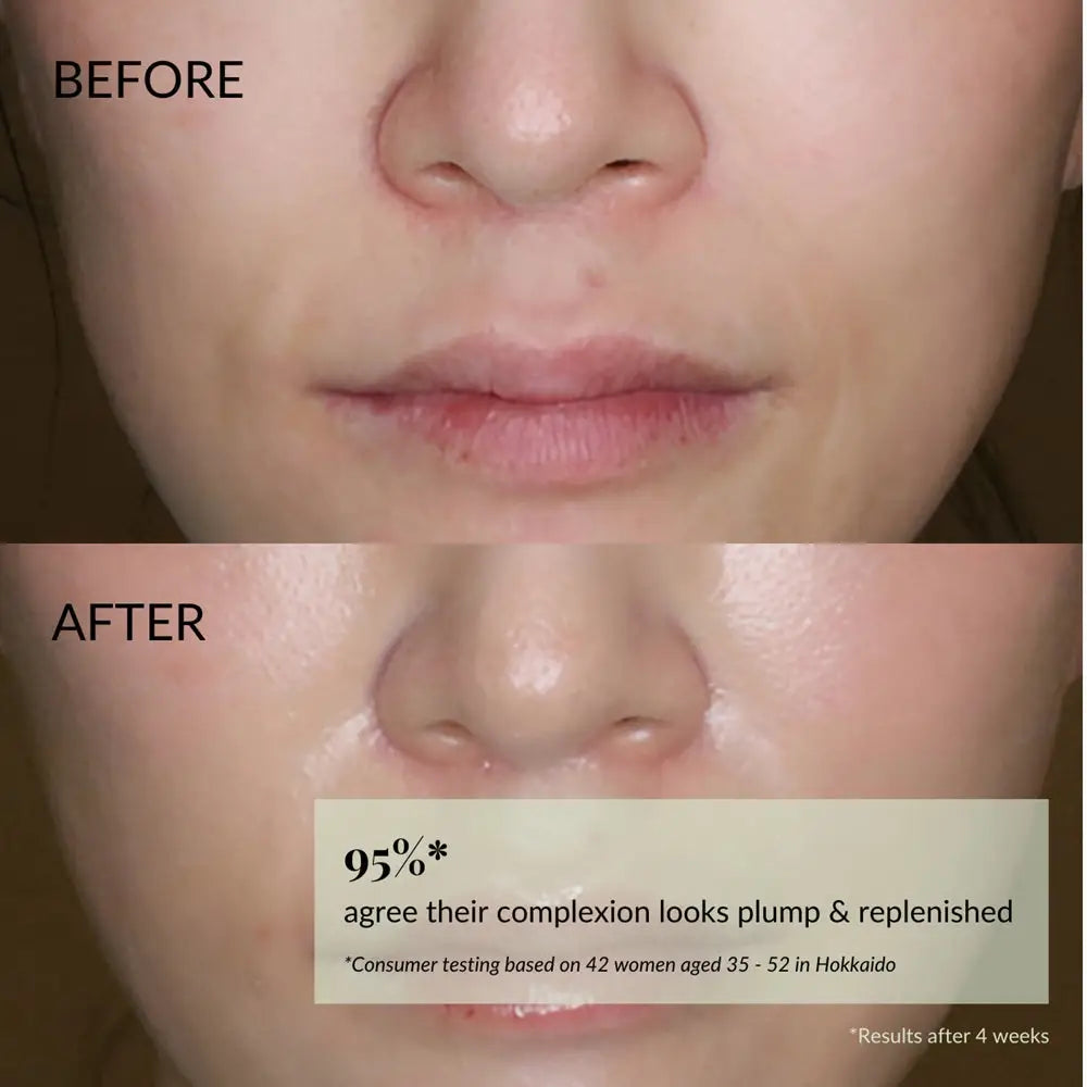 IREN Shizen Freeze the Youth – Prémium Japán Anti-Aging Arckrém Hófülgombával és BIYUSEN™ Termálvízzel az Intenzív