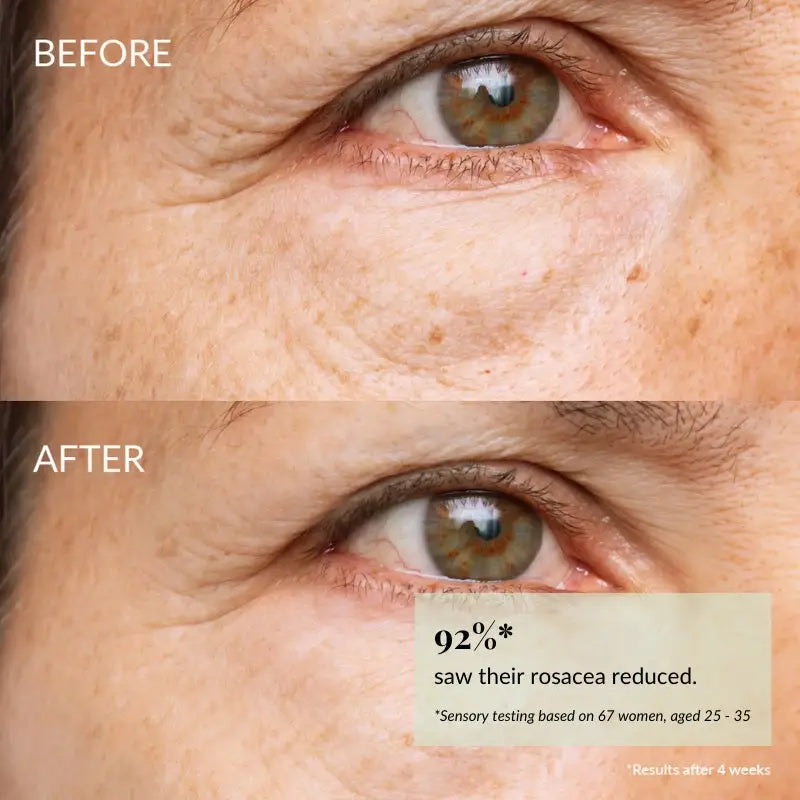 IREN Shizen Skin Reboot 20ml – Japán Antioxidáns Szérum Gránátalmával Koffeinnel és Vörös Algával a Sugárzó Védett