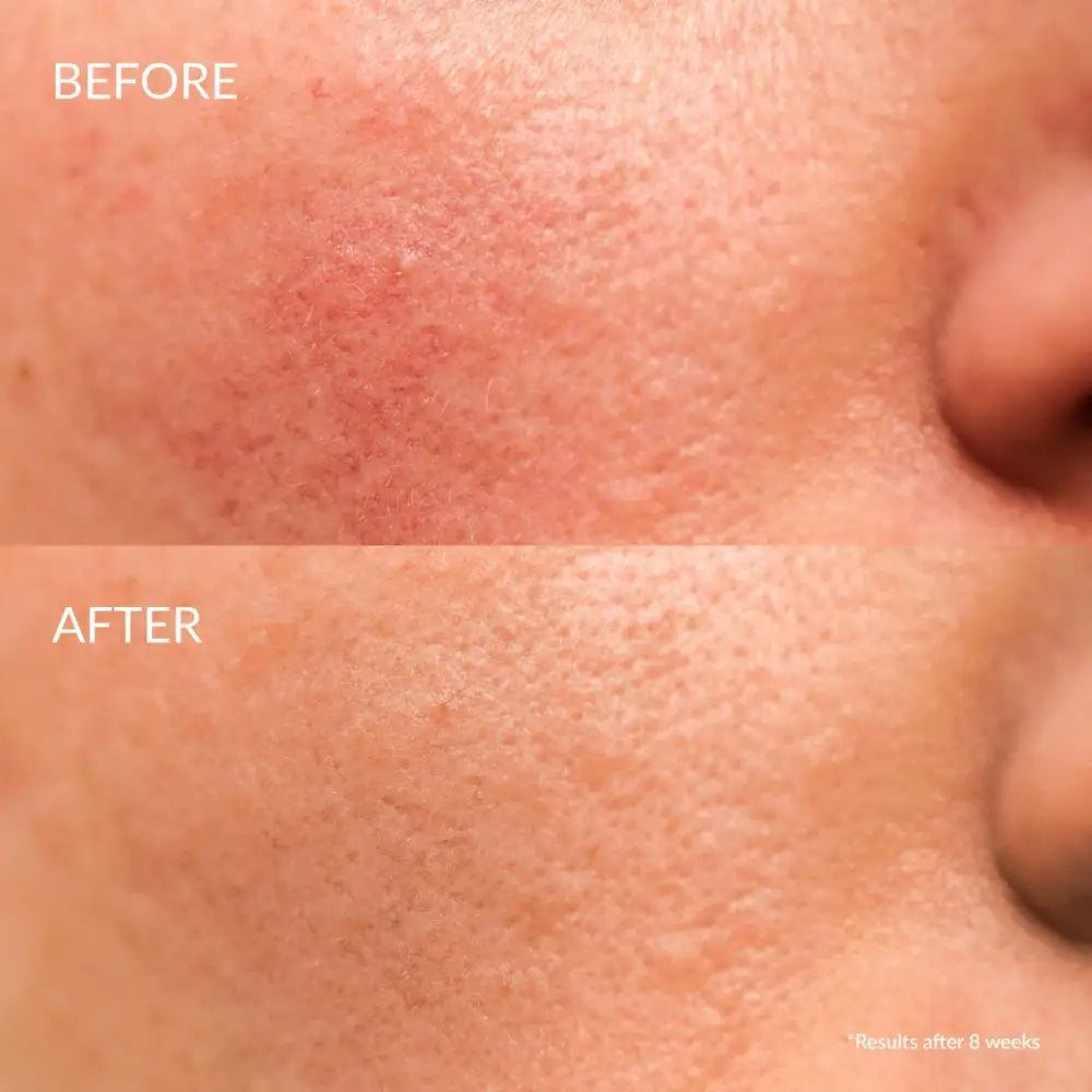 IREN Shizen Star Light 20ml – Japán ragyogást fokozó arcszérum Yuzuval Alpha-Arbutinnal és Niacinamiddal