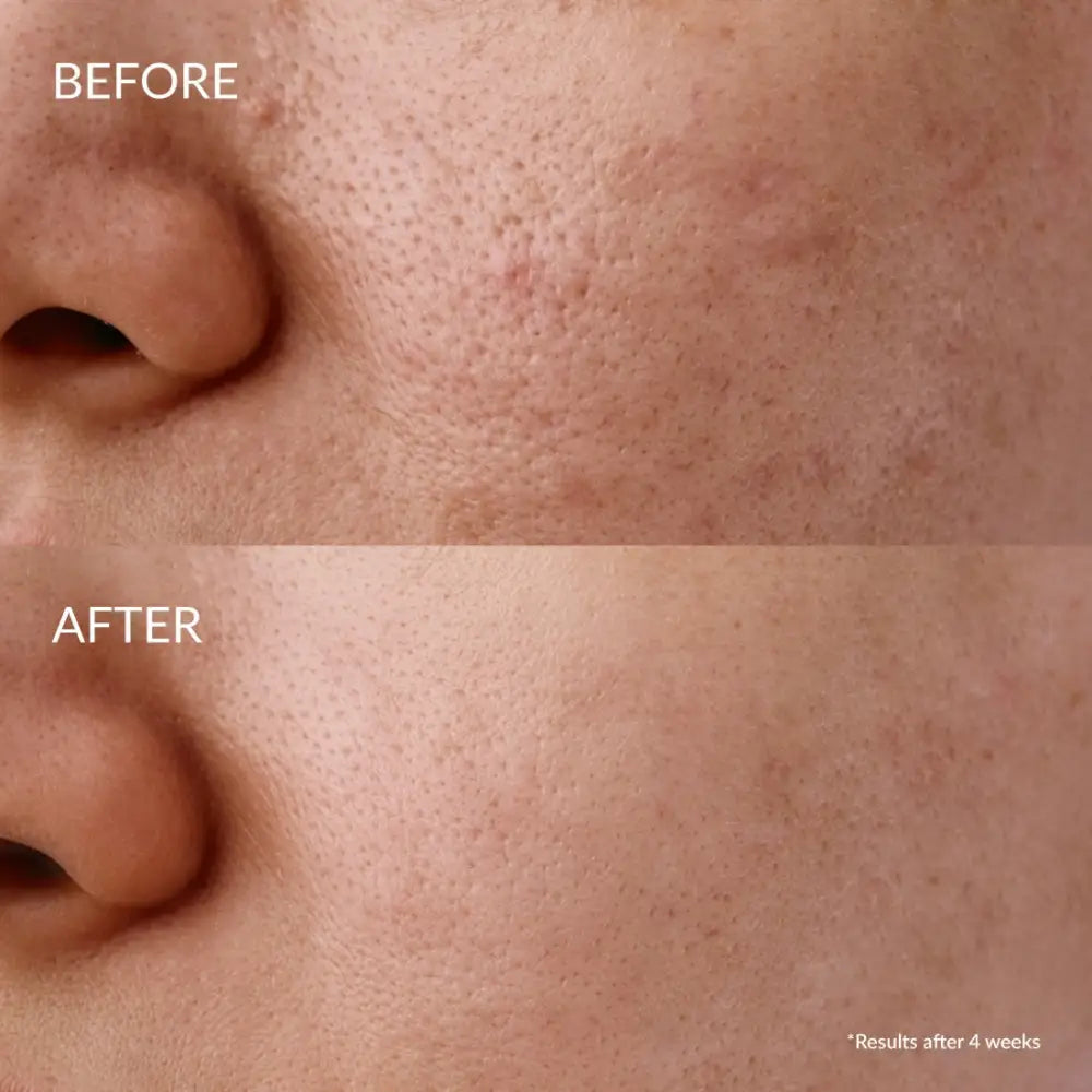 IREN Shizen Star Light 20ml – Japán ragyogást fokozó arcszérum Yuzuval Alpha-Arbutinnal és Niacinamiddal