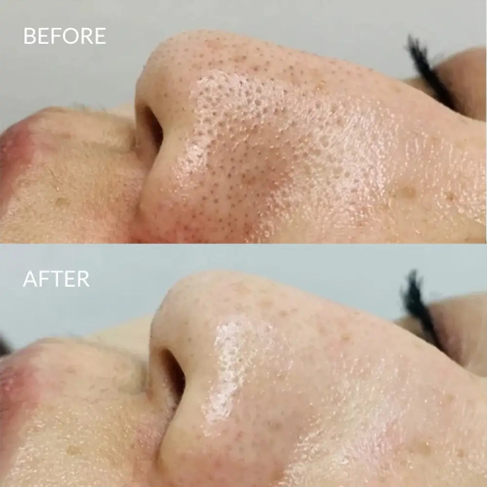 IREN Shizen Star Light 20ml – Japán ragyogást fokozó arcszérum Yuzuval Alpha-Arbutinnal és Niacinamiddal