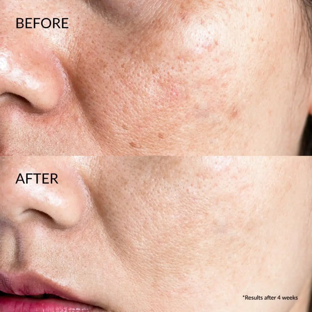 IREN Shizen Star Light 20ml – Japán ragyogást fokozó arcszérum Yuzuval Alpha-Arbutinnal és Niacinamiddal