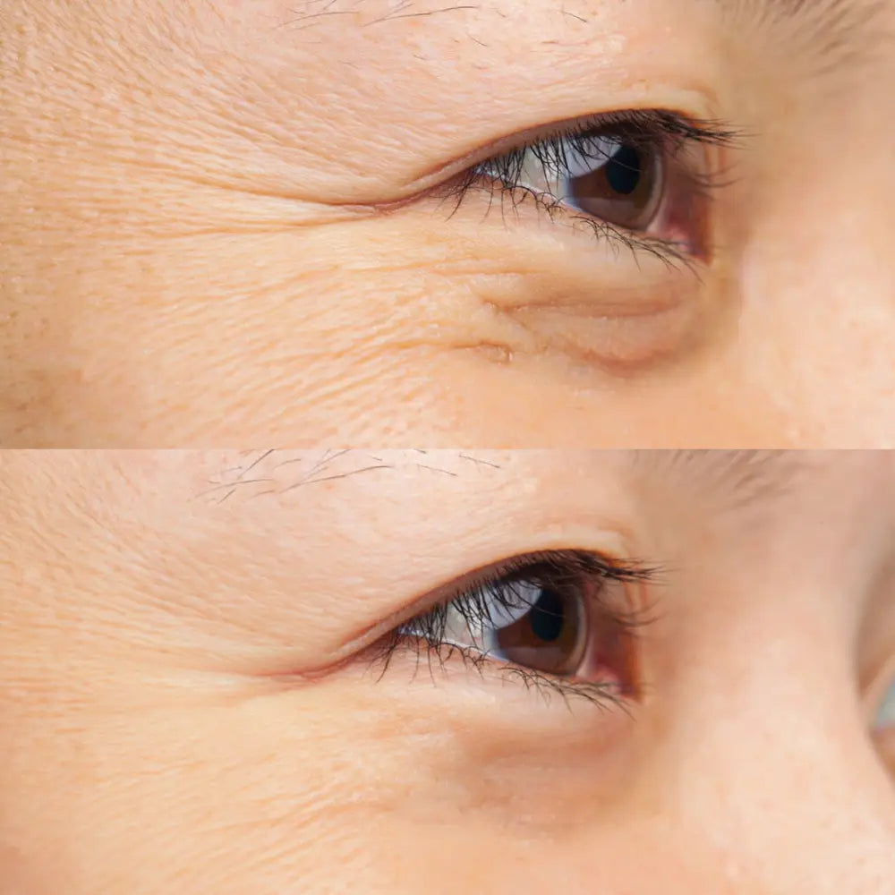 IREN Shizen Star Light 20ml – Japán ragyogást fokozó arcszérum Yuzuval Alpha-Arbutinnal és Niacinamiddal