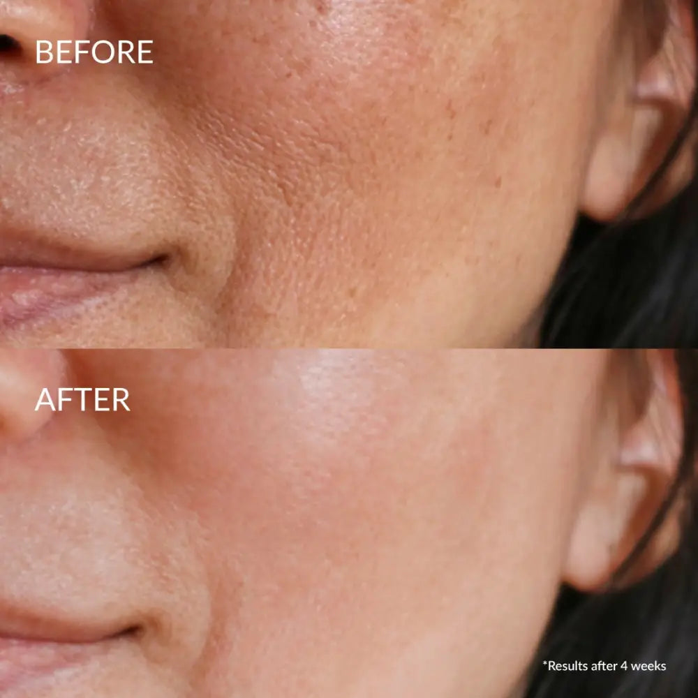 IREN Shizen Star Light 20ml – Japán ragyogást fokozó arcszérum Yuzuval Alpha-Arbutinnal és Niacinamiddal