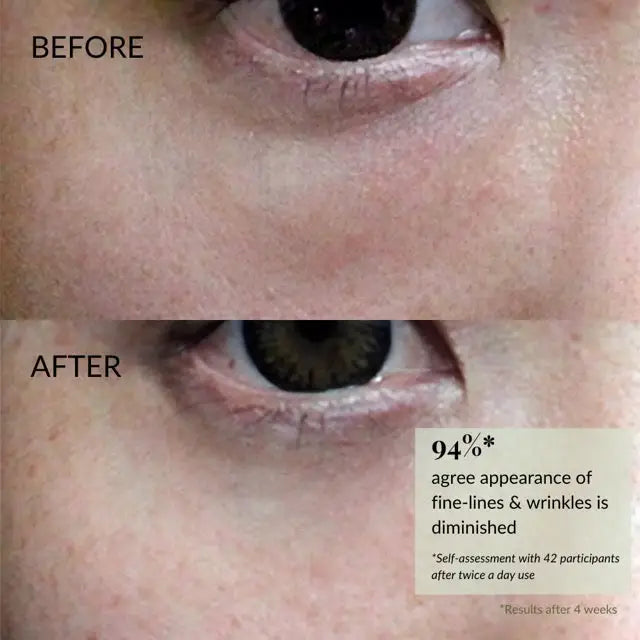 IREN Shizen TIMELESS ELIXIR 15ml – Japán Szem- és Ajakkontúr Krém Bakuchiollal és Platinabevonatú Masszázsrollerrel