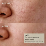 IREN Shizen GLOW UP Discovery Kit – Japán Anti-Aging Szérumtrió a Ragyogó Feszes és Megújult Arcbőrért - Kozmetika